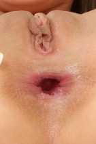 Anal Cherry Popping